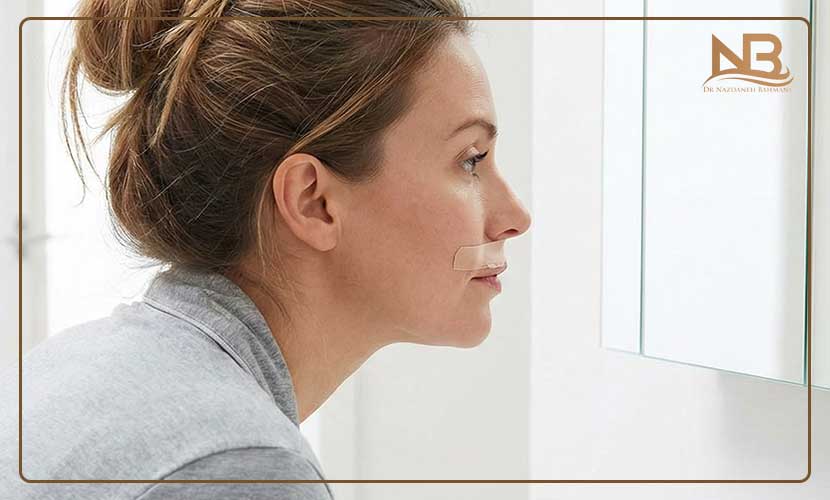 تا چند روز بعد از فیلر لب باید چسب زد؟ 12 عوارض و پیامدهای چسب نزدن لب بعد از فیلر