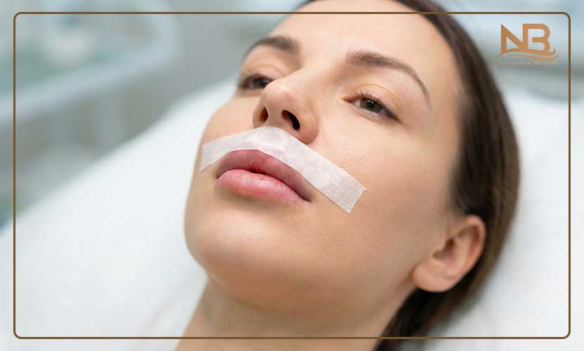 تا چند روز بعد از فیلر لب باید چسب زد؟ 11 مزایای اصلی چسب زدن لب بعد از تزریق ژل