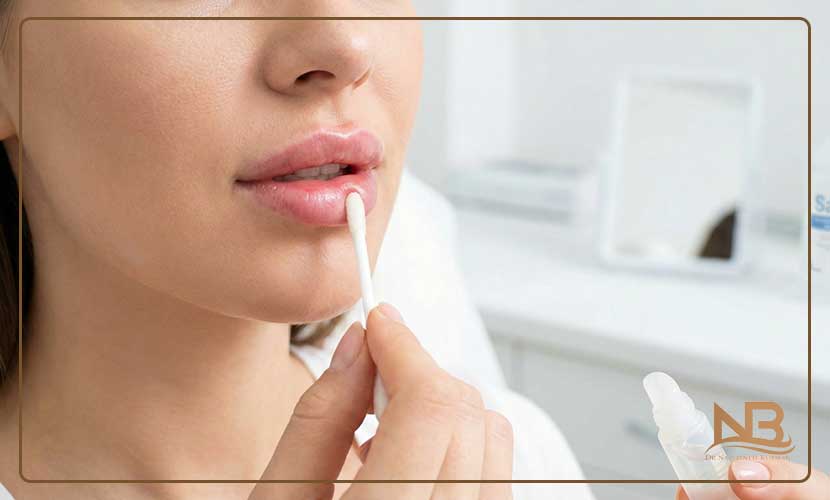 چند روز بعد از تزریق ژل لب میشه رژ زد؟ 18 چه زمانی بعد از تزریق ژل میتوان آرایش کامل انجام داد؟