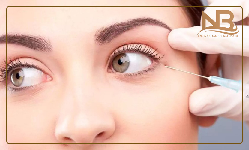 عوارض بوتاکس چیست و چگونه درمان می شود؟ 18 عوارض بوتاکس پیشانی