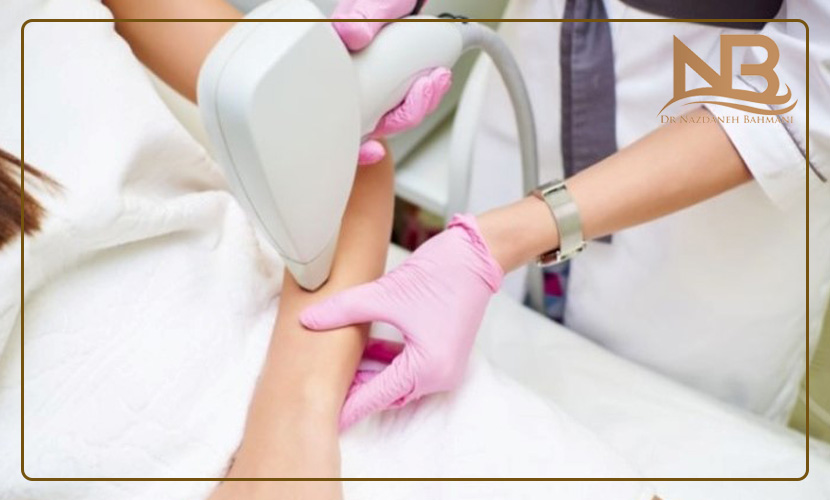 بهترین دستگاه لیزر موهای زائد چیست؟ 24 بهترین دستگاه لیزر موهای زائد