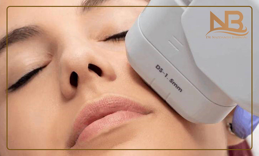 هزینه و قیمت هایفوتراپی 16 قیمت هایفوتراپی