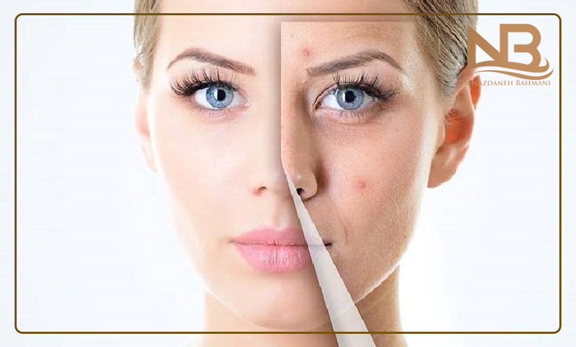 هزینه و قیمت هایفوتراپی 18 قیمت هایفوتراپی