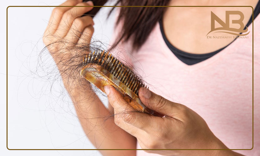 علت ریزش مو در زنان