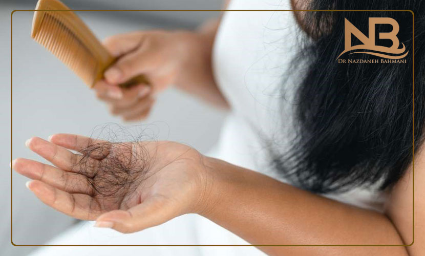 ریزش مو در زنان