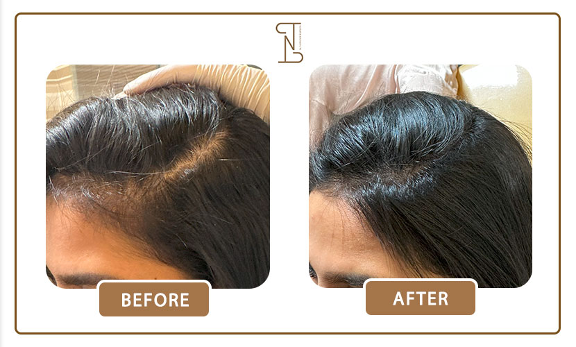 نمونه-کار-درمان-مو-11