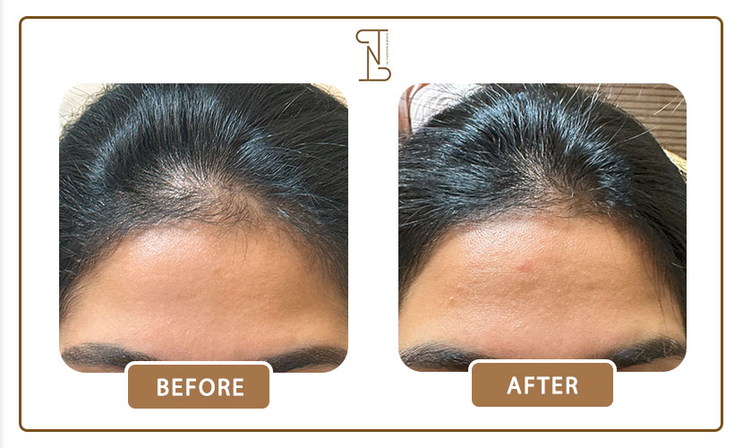 نمونه-کار-درمان-مو-12