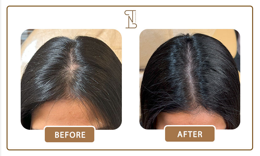 نمونه-کار-درمان-مو-13