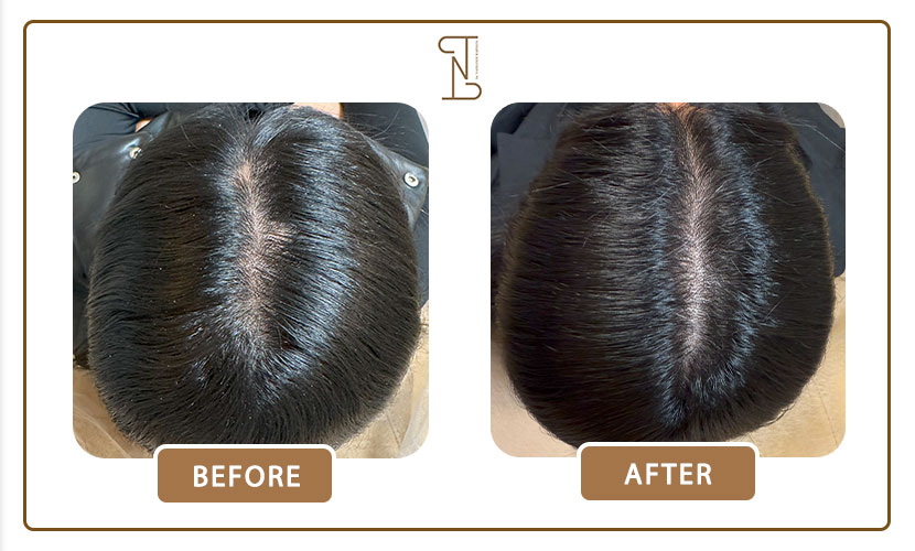 نمونه-کار-درمان-مو-14