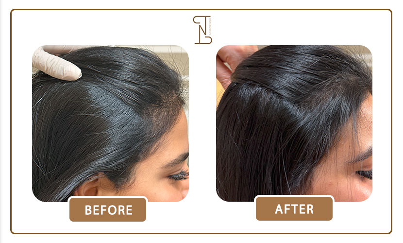 نمونه-کار-درمان-مو-15