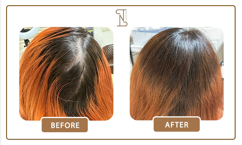 نمونه-کار-درمان-مو-16