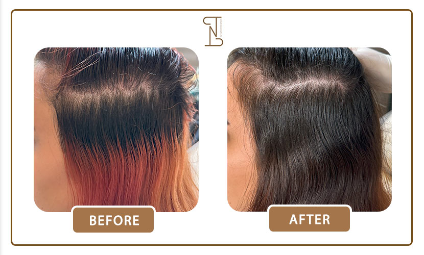 نمونه-کار-درمان-مو-17