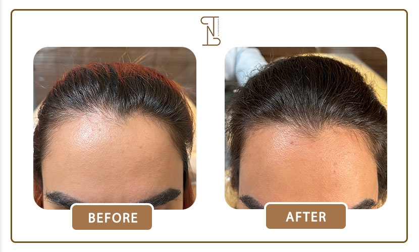 نمونه-کار-درمان-مو-18