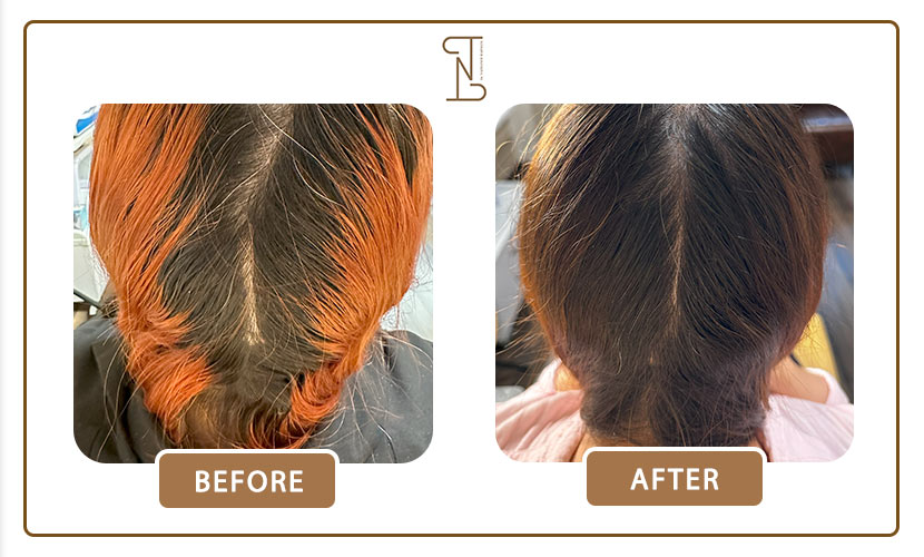 نمونه-کار-درمان-مو-19