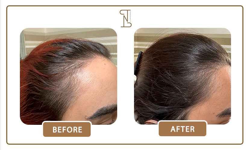 نمونه-کار-درمان-مو-20