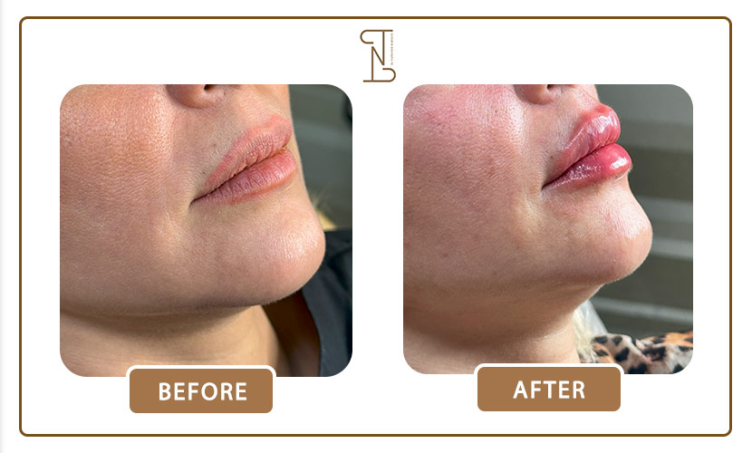 نمونه-کار-لب-13