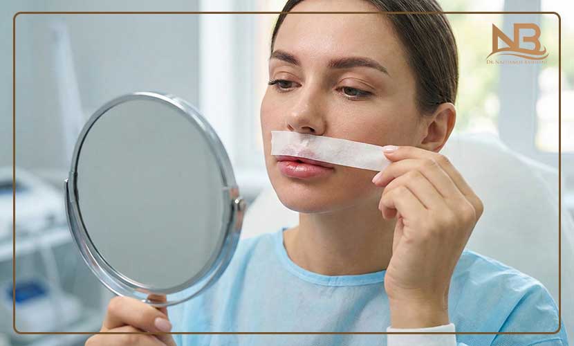 تا چند روز بعد از فیلر لب باید چسب زد؟