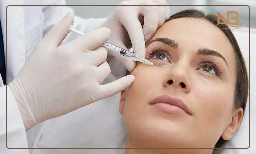 اثر فیلر زیر چشم کی مشخص می‌شود؟